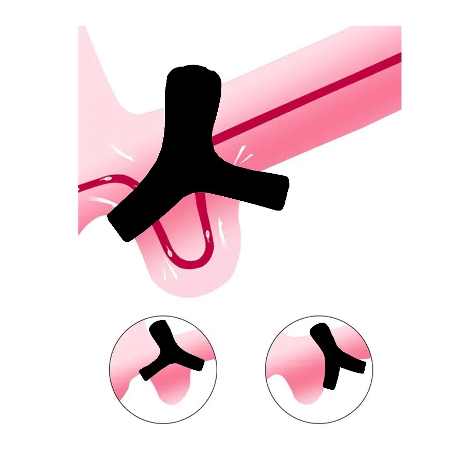 Iris – Anneau Pénien & Testicules, Silicone – Anti-éjaculation