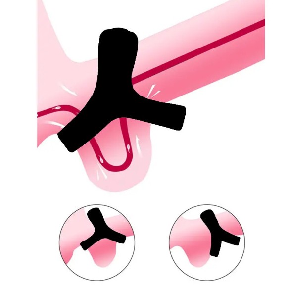 Iris – Anneau Pénien & Testicules, Silicone – Anti-éjaculation